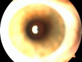 Mein Auge